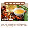 EELHOE Batana Oil Conditioner Moisturizes, Hydrates, Improves Dry Hair, Softens And Fluffs Hair Care