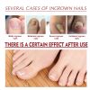 Jaysuing Nail Care Oil Soft Nail Brightening Repair Nail Inlay Thickening Grey Nail Care Oil