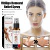 EELHOE Vitiligo Removal Relief Spray, Repair Whitening Spot Perspiration Beauty Moisturizing Skin Care spray