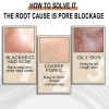 Jaysuing Lactose Solution, Exfoliate Remove Blackheads Shrink Pores Clean And Moisturize SkinEssence