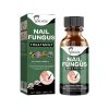 EELHOE Nail Care Solution For Nail Surface Thick Nails Soft Nails Gentle Cleansing And Moisturizing Treatment Solution