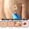 Ximonth Wart And Tags Removal Spray, Cleanse And Fade Body Moles Smooth Skin Repair Spray