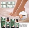 EELHOE Nail Care Solution For Nail Surface Thick Nails Soft Nails Gentle Cleansing And Moisturizing Treatment Solution